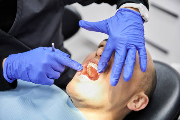 Best Urgent Care for Lost Fillings or Crowns in Murfreesboro, NC